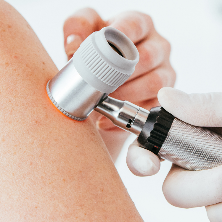 Hautuntersuchung bei Dr. Peter Seiringer: Nahaufnahme einer dermatologischen Untersuchung mit einem Dermatoskop, durchgeführt von einer medizinischen Fachkraft. Modernste Diagnosetechniken für die Hautgesundheit in der Praxis Dr. Seiringer.