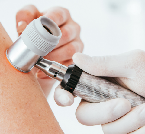 Hautuntersuchung bei Dr. Peter Seiringer: Nahaufnahme einer dermatologischen Untersuchung mit einem Dermatoskop, durchgeführt von einer medizinischen Fachkraft. Modernste Diagnosetechniken für die Hautgesundheit in der Praxis Dr. Seiringer.